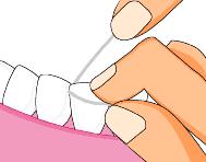 中年牙缝越来越大是什么原因,牙齿越来越稀疏牙缝大怎么办