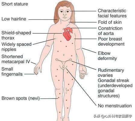 胸主动脉瘤最常见的护理措施,胸主动脉疾病