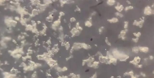 肚脐眼用显微镜放大1000倍,抠肚脐眼里的泥全过程