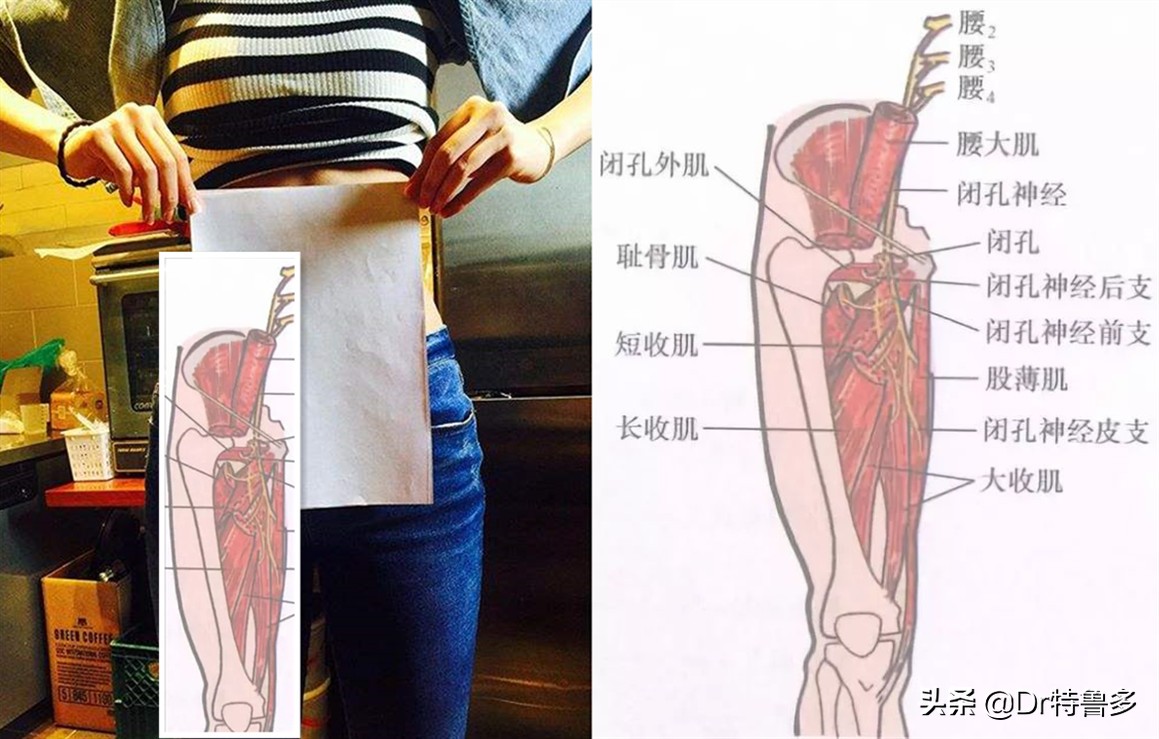 大腿内侧疼是压迫哪根神经引起的,大腿内侧神经疼要警惕
