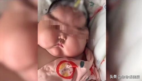 激素大头娃娃事件,大头娃娃事件中检出的激素是什么