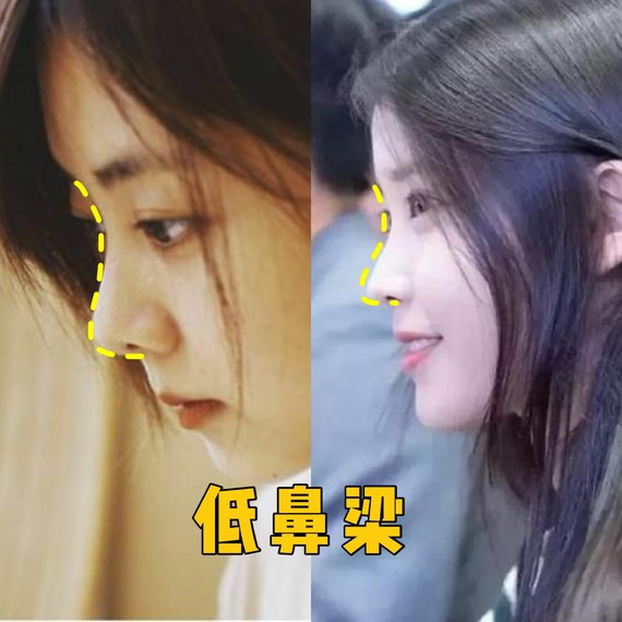 好看的鼻子类型驼峰鼻,好看的鼻型有哪几种