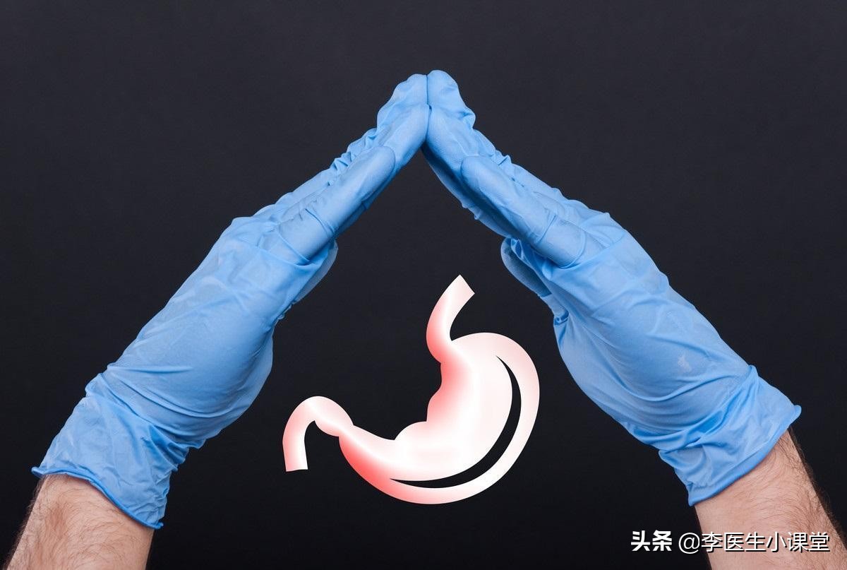 萎缩性胃炎到胃癌经历几步,慢性萎缩性胃炎复发变胃癌吗