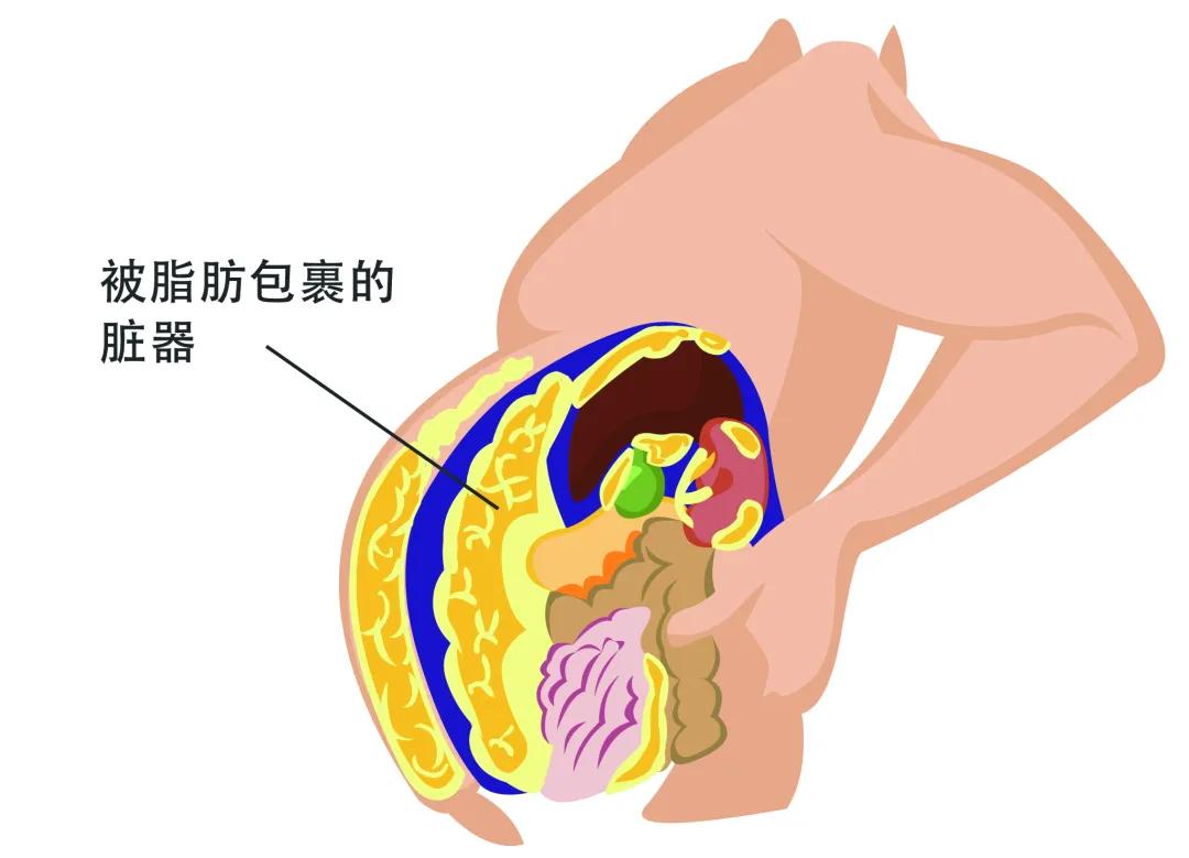 肚子一抓一坨赘肉能减下去吗,肚子一抓一大把肉怎么办