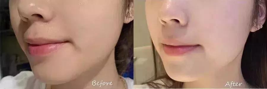 韩国小灯泡美白精华怎么样,韩国小灯泡精华真的能变白吗