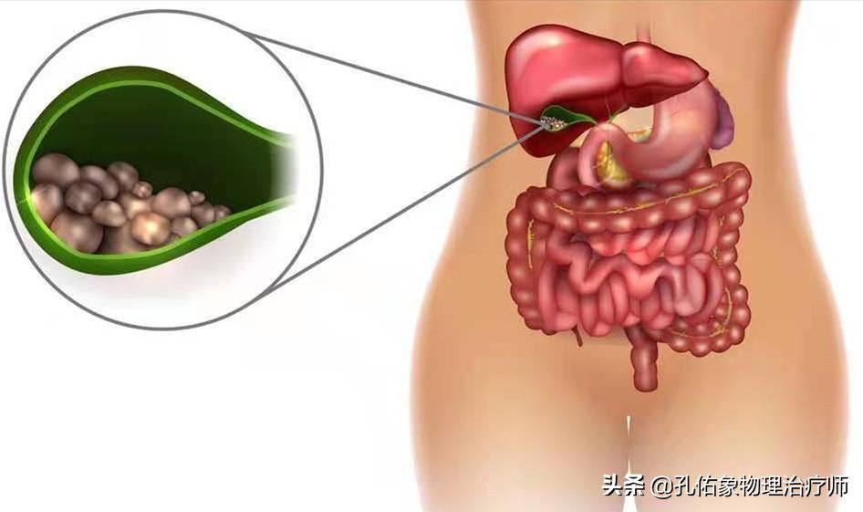 肩膀疼是肩周炎吗还是其他原因,肩周炎肩膀疼痛怎么锻炼