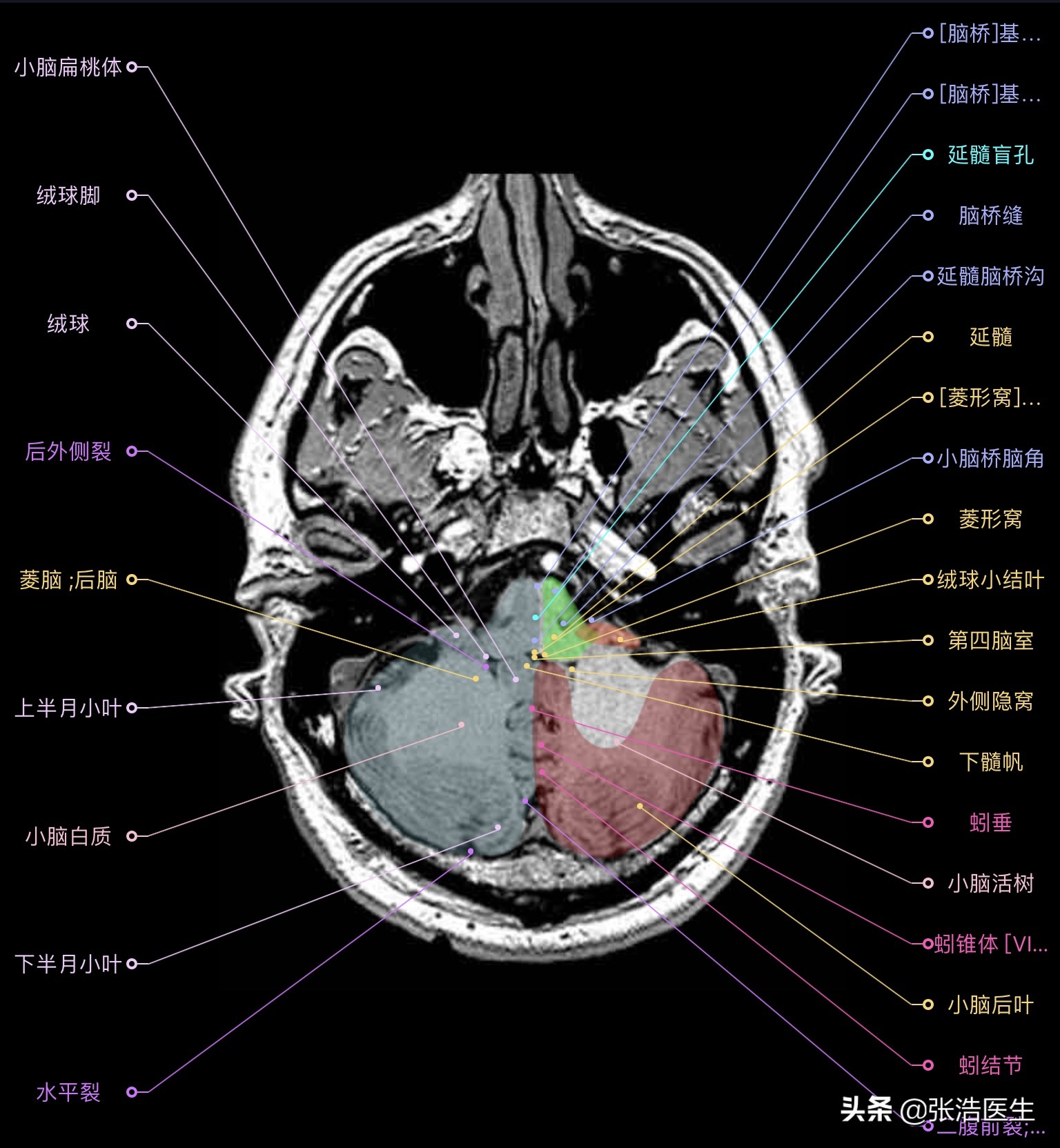 颅脑mri断层解剖视频课件,颅脑mri解剖手绘图