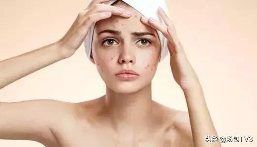 秋来湿未去！有这几个症状的人，你湿气太重了！快学一招排湿毒