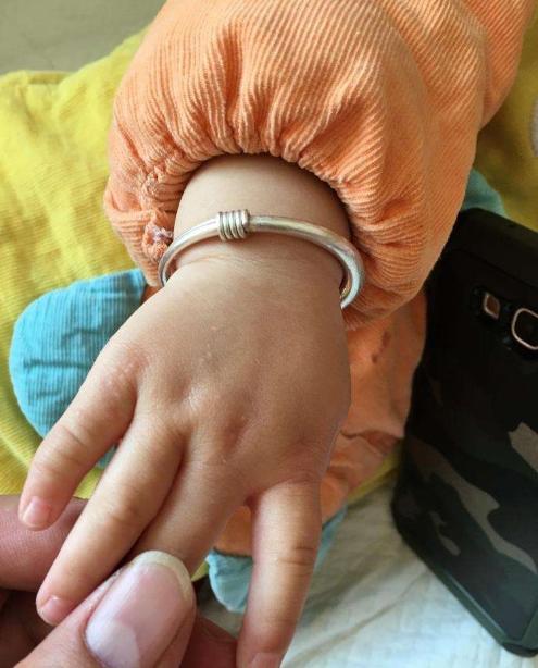 宝宝被门夹擦什么快好,婴儿被门夹伤该怎么办