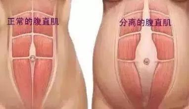 生完宝宝为什么肚子很难瘦,生完孩子瘦肚子健身操30分钟