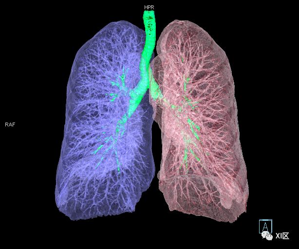 如此详细的肺部影像解剖，有点儿酷！