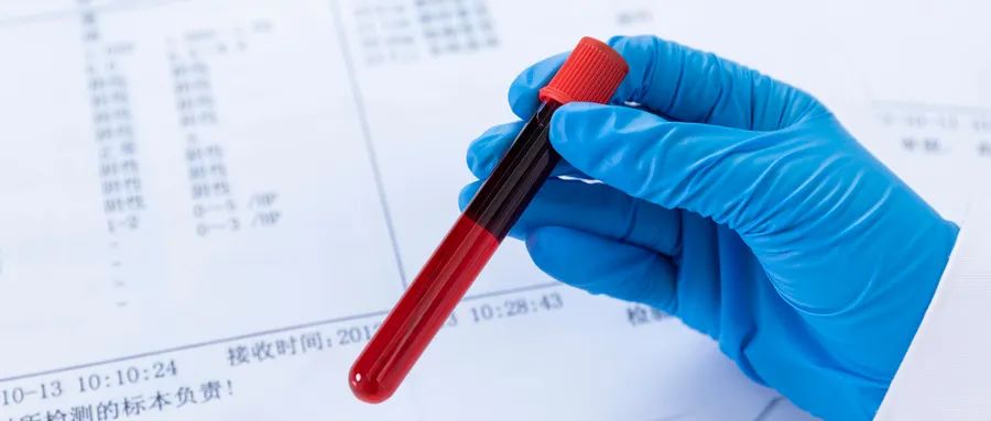 同型半胱氨酸高的危害和症状,同型半胱氨酸偏高的危害