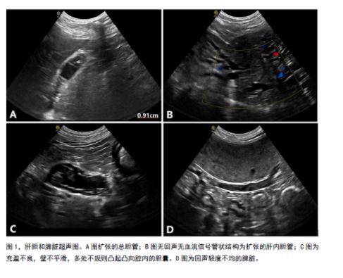 不吃饭会得急性肠炎吗,不吃饭胆结石会犯吗