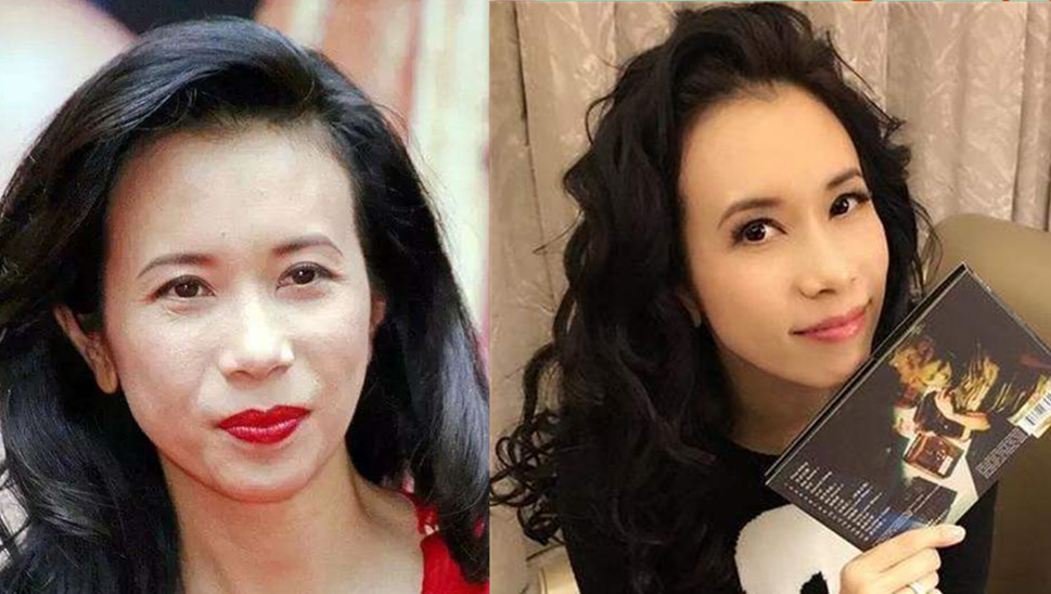 凸嘴皮肤不好怎么逆袭,凸嘴如何逆袭完美侧脸