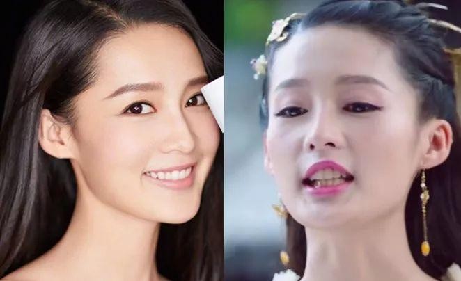 牙黄怎么办教你一招美白不花钱,如何解决牙黄最快最简单的方法