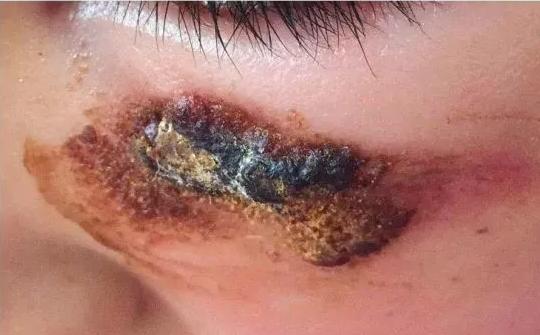 芦荟胶是美容专用的吗,芦荟胶是适合任何肤质的吗