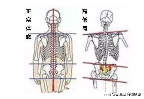 小孩走路弓腰驼背练什么锻炼气质,小孩子改善驼背和脖子前倾的运动