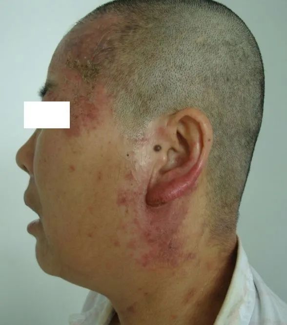 贵州绿太阳千万皮肤防护药品助力“逆行者”打好抗疫阻击战