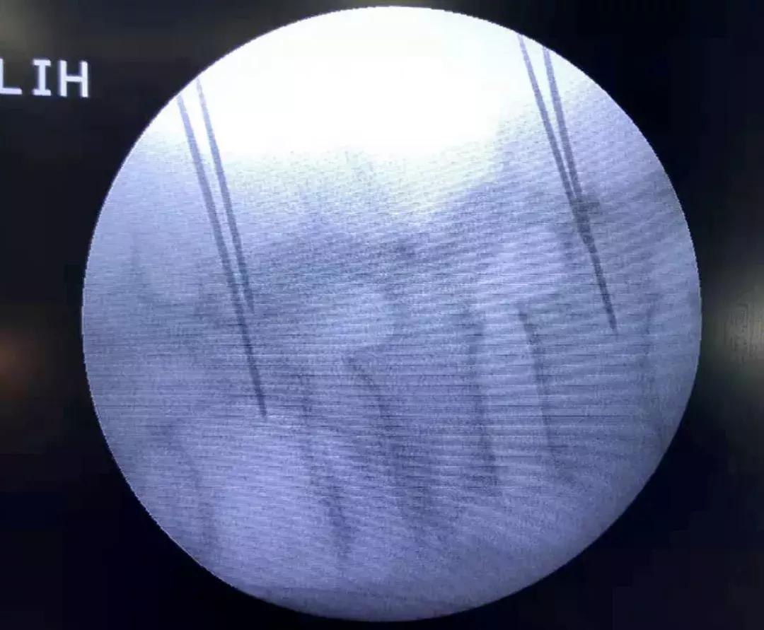 锦州发明专利,锦州实用新型专利