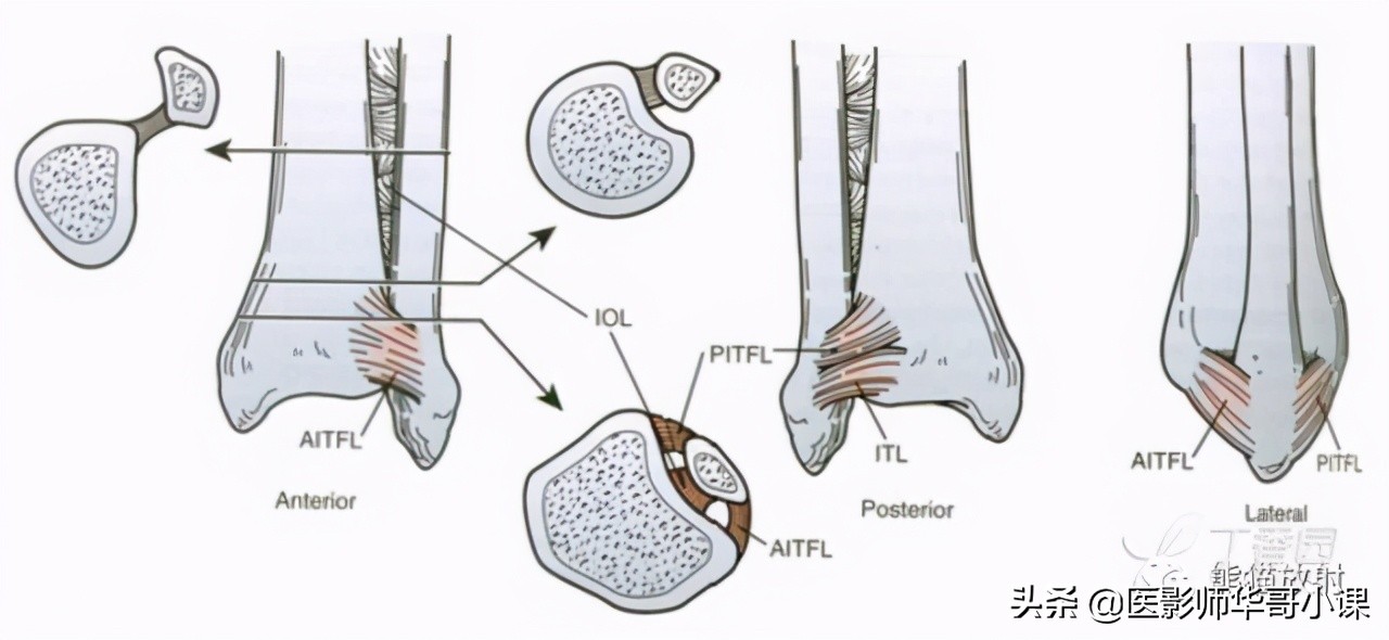 踝关节解剖视频课,解剖学韧带分布图