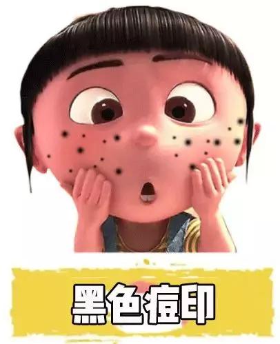 女生爆痘必买清单药膏,战痘效果最好的药