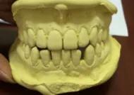 杭州牙齿矫正口腔医院,杭州牙齿矫正哪里最便宜