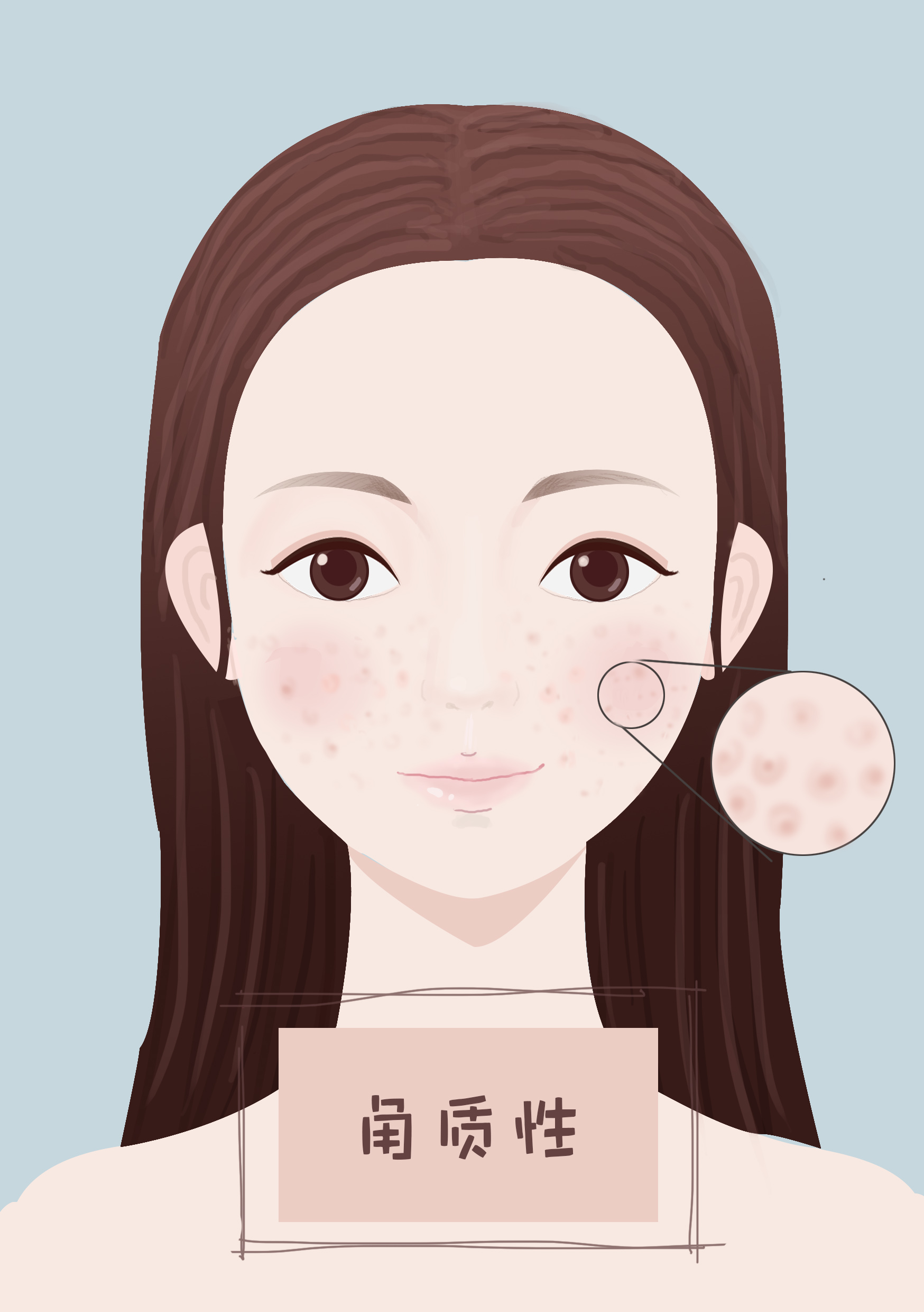 皮肤毛孔粗大痘痘不断怎么保养,毛孔粗大肌肤怎么护理