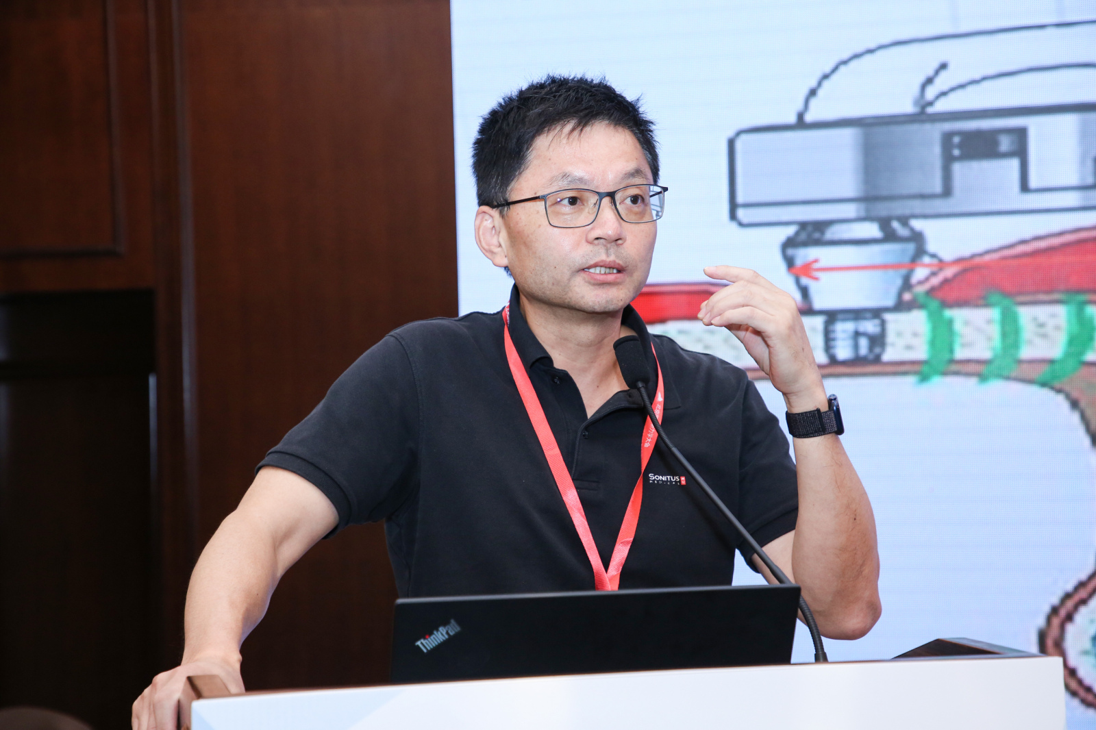 圆桌论坛：单侧聋和不对称性听力损失的干预