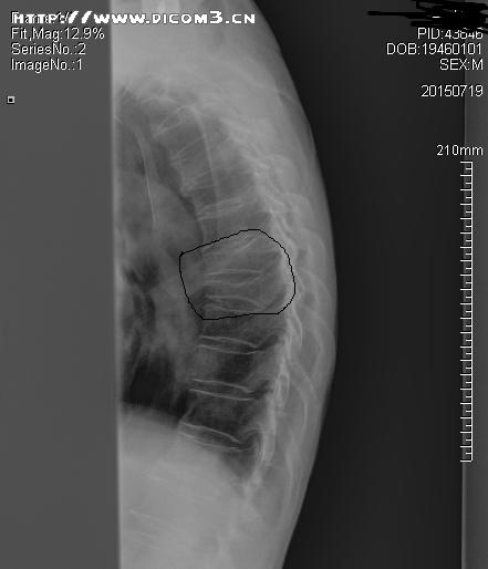 粑粑去哪儿,粑粑去哪了