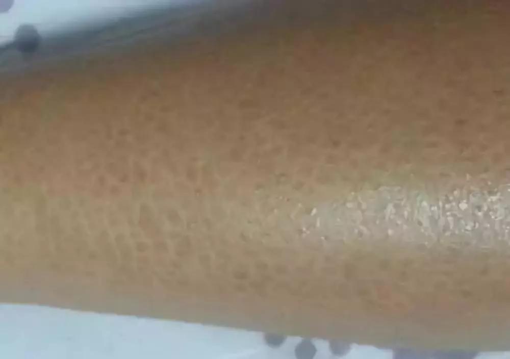 拯救干皮的护肤品,山羊奶手工皂去黑头去鸡皮肤