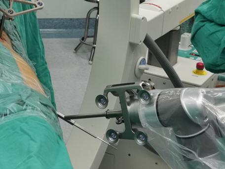 医生的“透视眼”、“稳定手”这位完美医助是咋工作的？