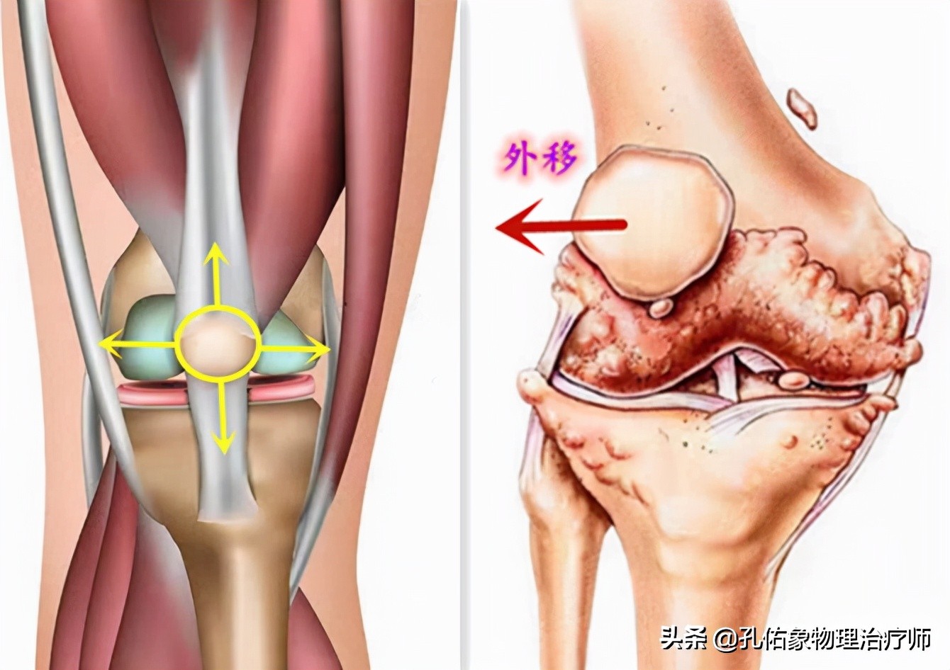 老年人腿脚无力要怎么避免,专治老年人下肢无力的方法