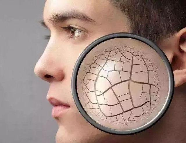 皮肤为什么会变干变硬,干燥的皮肤怎样变得水润