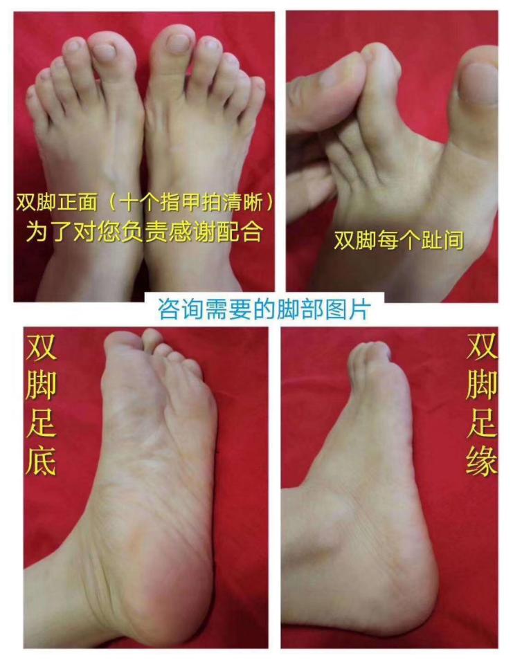 及时治疗脚气,是对家人最好的负责