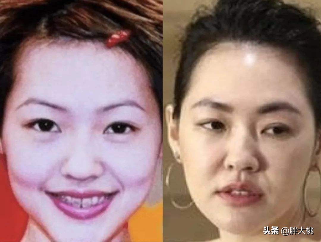 法令纹早出现还是晚出现好,什么样的人不容易长法令纹