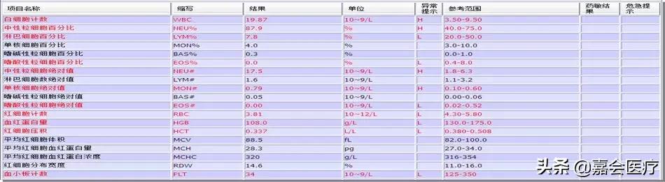 低烧大腿根烧痛是怎么回事,发热腿疼是什么原因