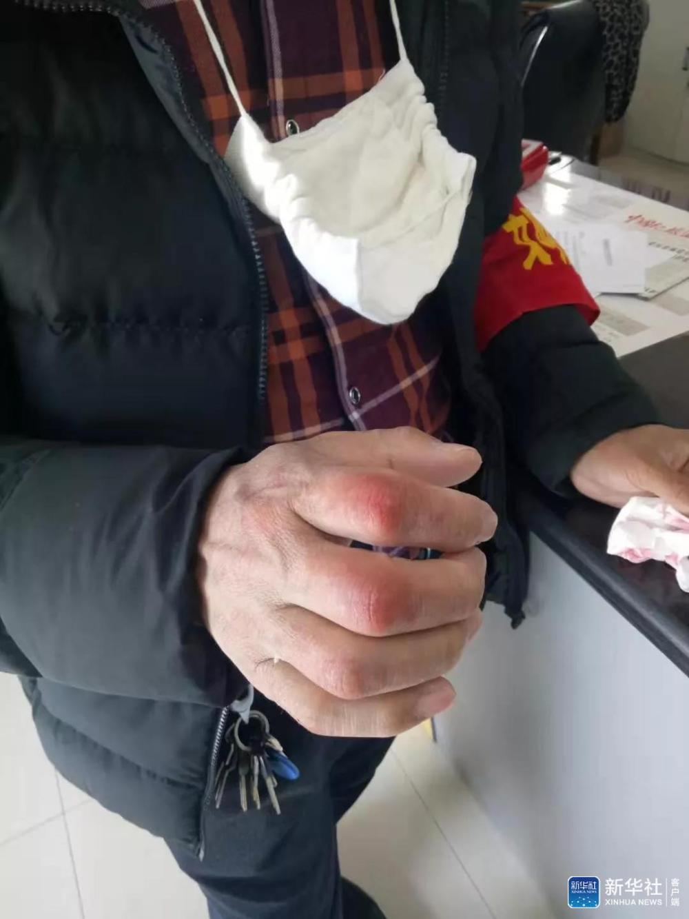 习*平近**总书记关切事丨战“疫”中的“凡人微光”