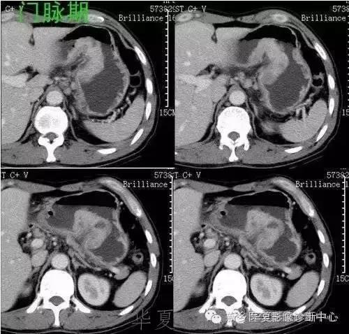 这些部位的黑色素瘤，您会诊断吗？