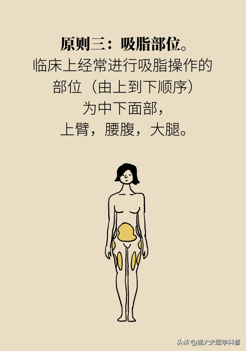 吸脂是怎么吸的,吸脂手术一次就可以吗