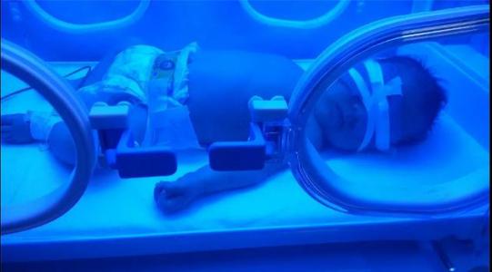 婴儿小黄人怎么处理,家有小黄蚂蚁怎么解决