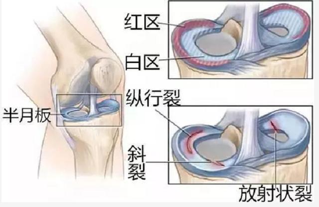 关节疼痛护膝可以缓解吗,关节疼痛带来的伤害