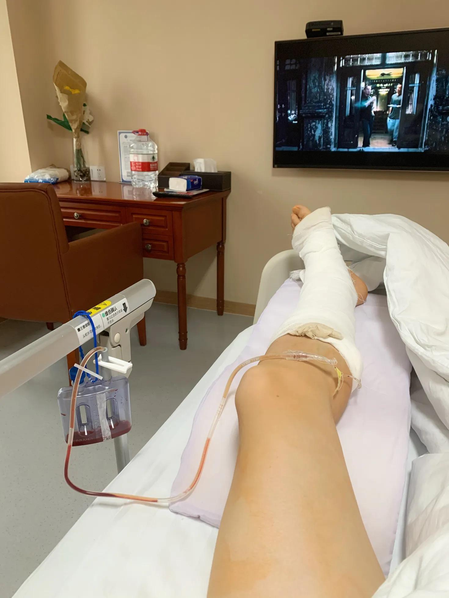 一张图看懂跟腱断裂,跟腱断裂日常