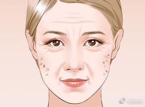 雀斑、*褐斑黄**、咖啡斑、晒斑、妊娠斑...分不清还谈什么祛斑
