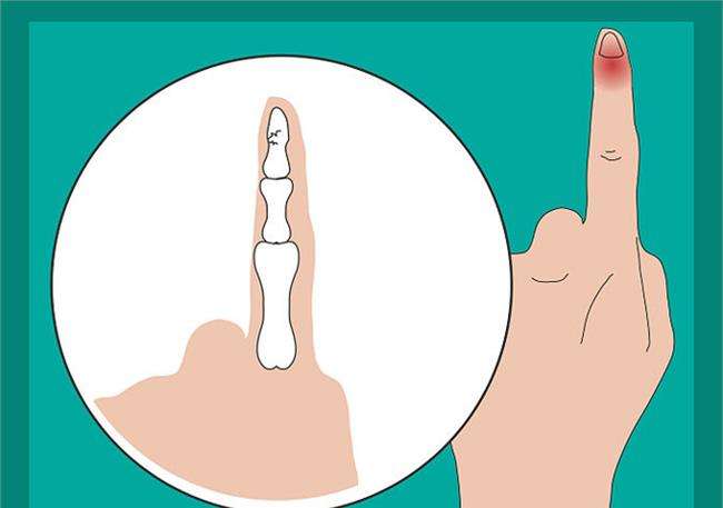 运动中的十大常识,运动中的注意事项有哪些