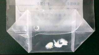 半月板缝合后面磁共振还显示撕裂,半月板缝合后为啥复查还是撕裂