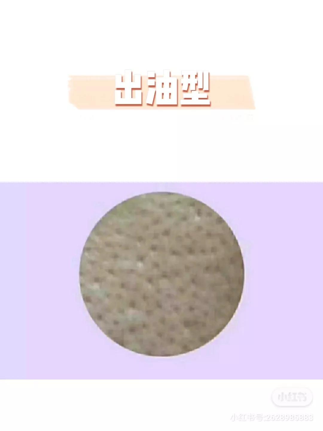 毛孔粗大全搞定这些知识要牢记,如何分辨毛孔粗大类型及改善毛孔