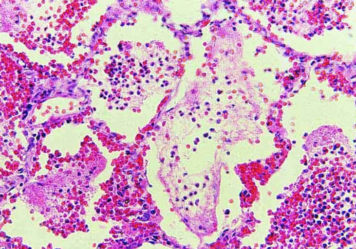 铲屎官容易被传染的病,小细菌对人体危害