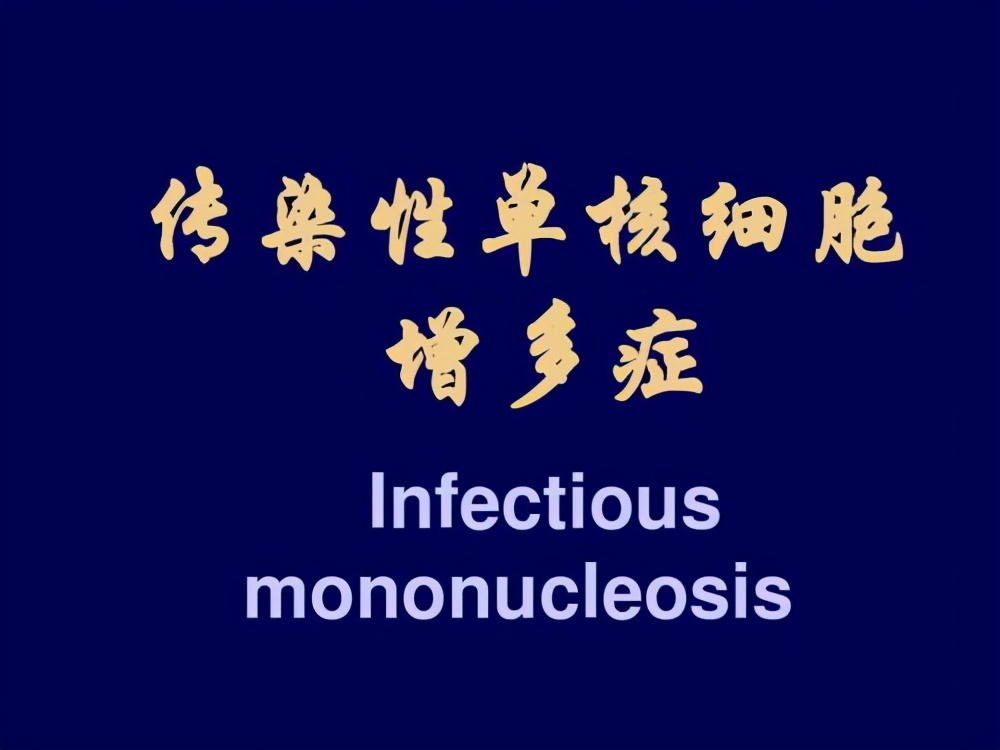 传染性急性单核细胞增多症,传染性单核细胞增多症有哪些
