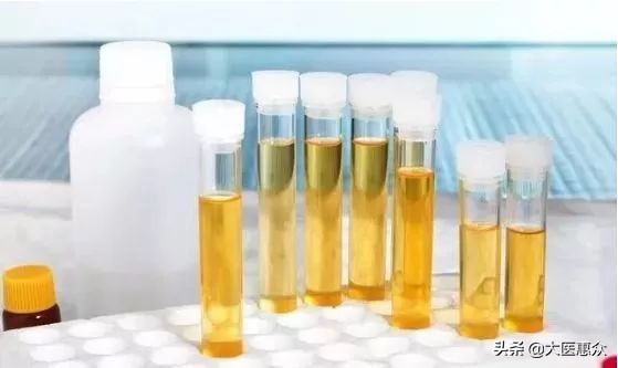 尿很骚是什么气味,尿很骚是什么原因引起的