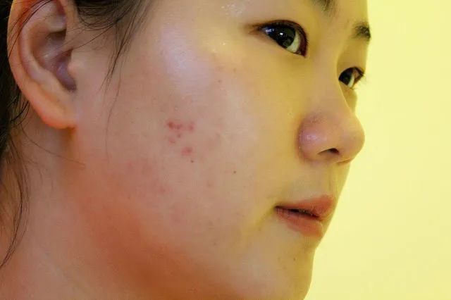 青春期女生越来越丑怎么办,高中女生不应该有哪几种行为